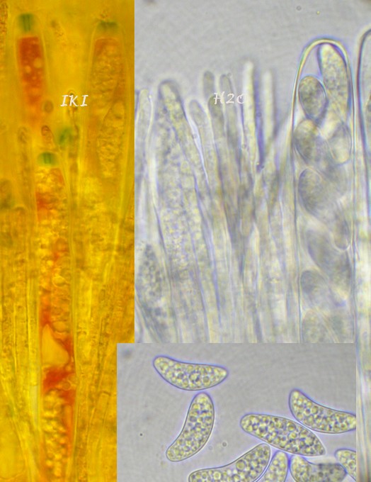 macrostoma
