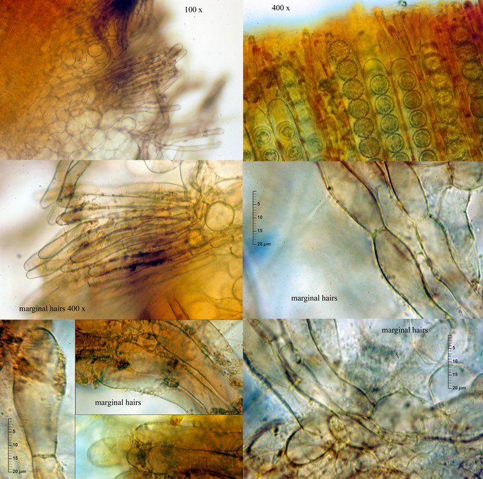 macrostoma