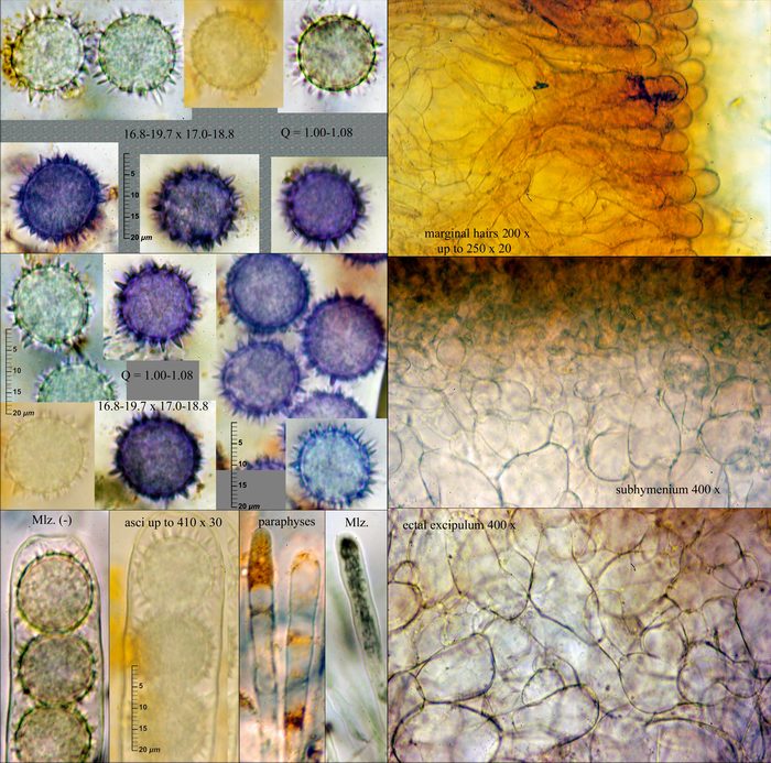 macrostoma