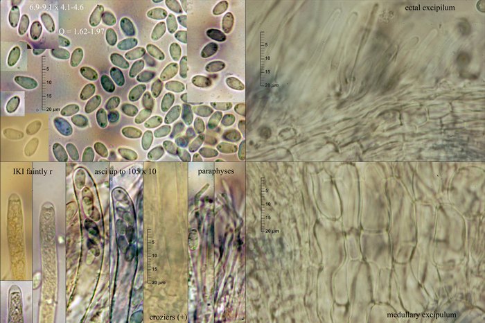 macrostoma