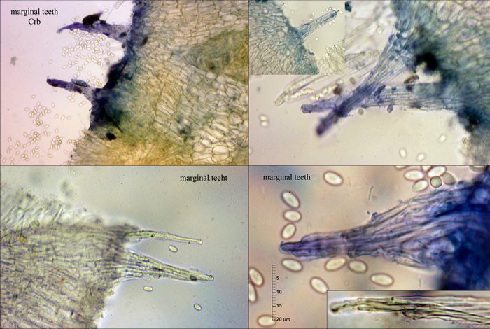 macrostoma