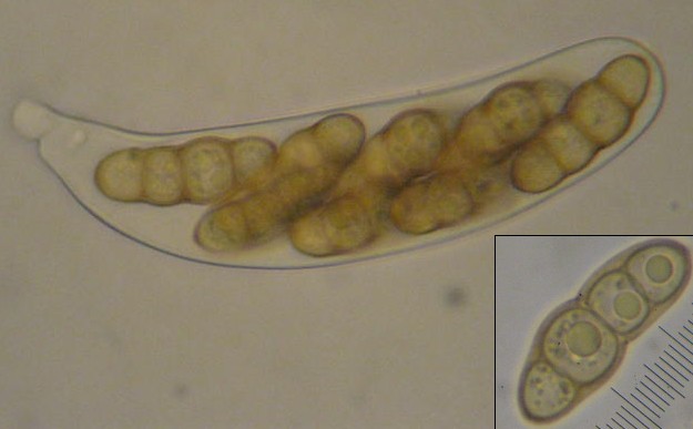 macrostoma