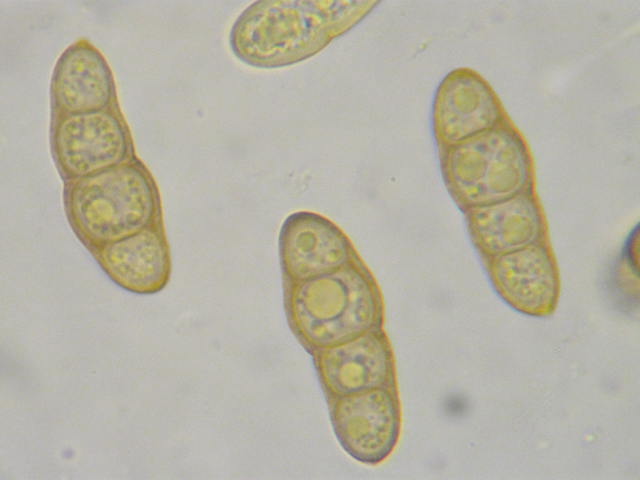 macrostoma