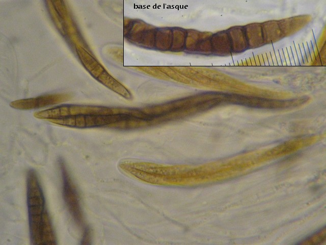 macrostoma