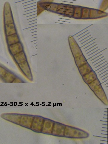 macrostoma