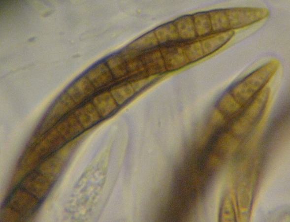 macrostoma