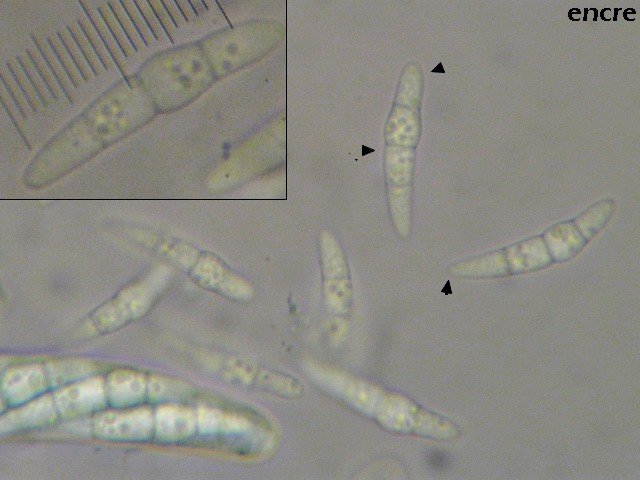 macrostoma