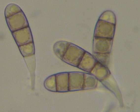 macrostoma