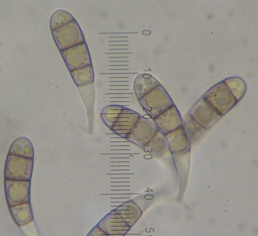 macrostoma