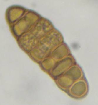 macrostoma