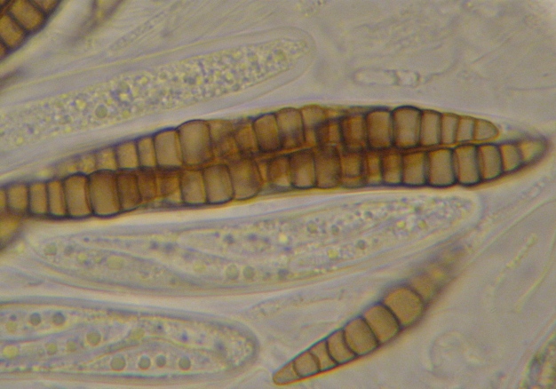 macrostoma
