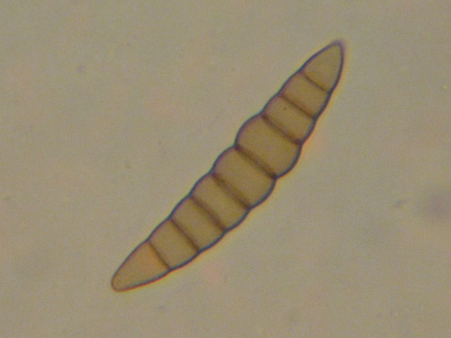 macrostoma