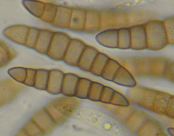 macrostoma