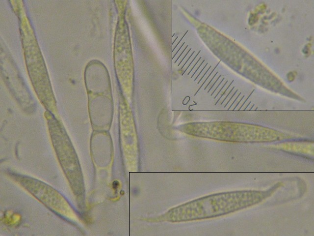 macrostoma