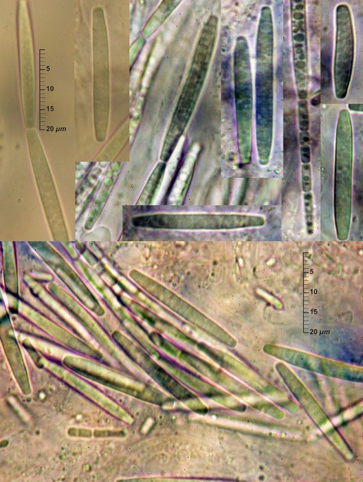 macrostoma