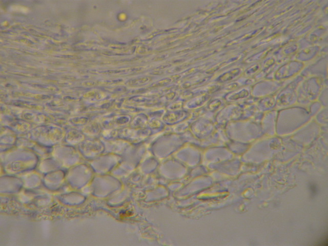 macrostoma