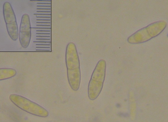 macrostoma