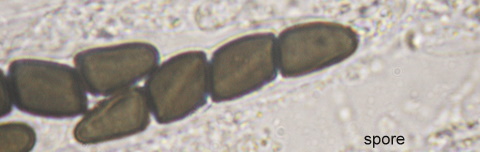 macrostoma