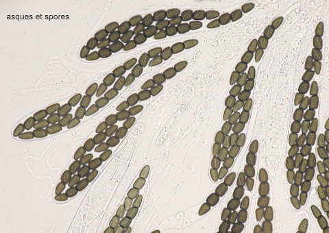 macrostoma