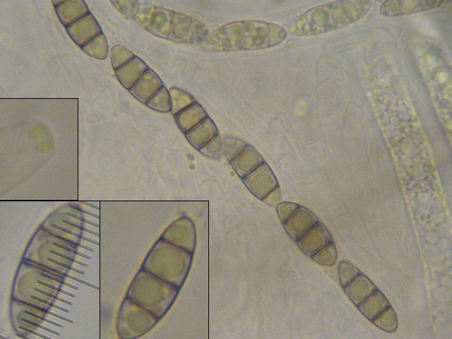 macrostoma