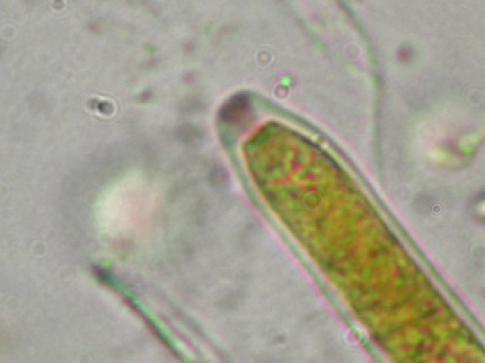 macrostoma