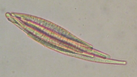 macrostoma