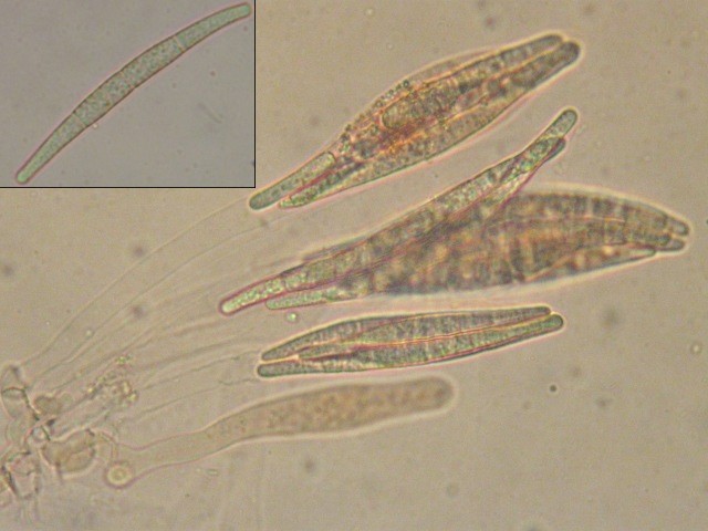 macrostoma