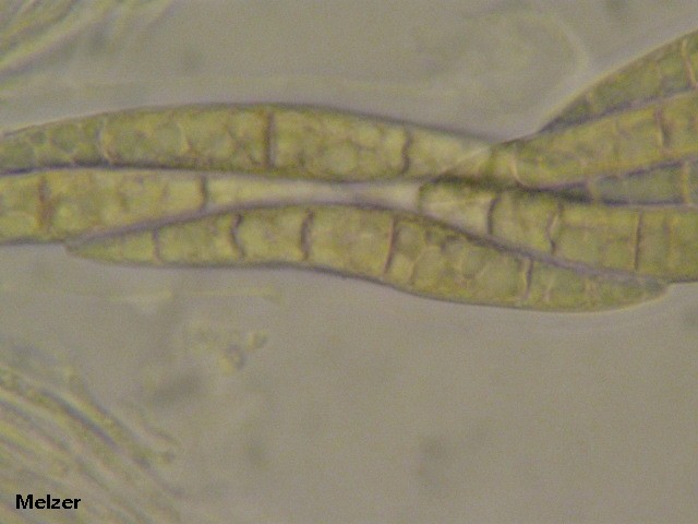macrostoma