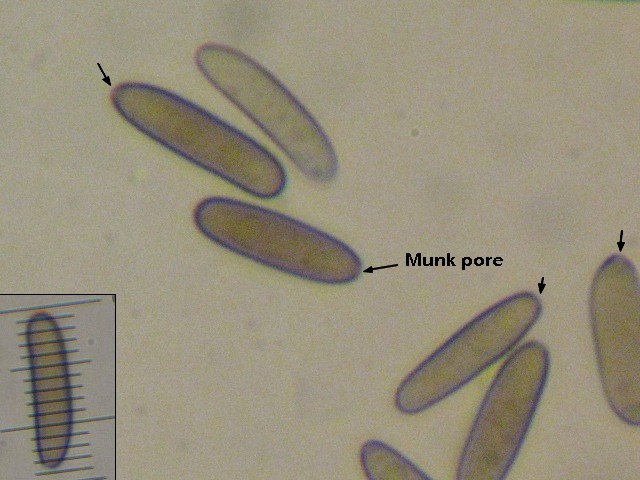 macrostoma