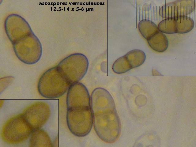 macrostoma