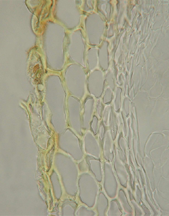 macrostoma