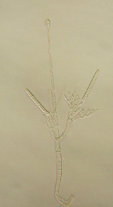 macrostoma