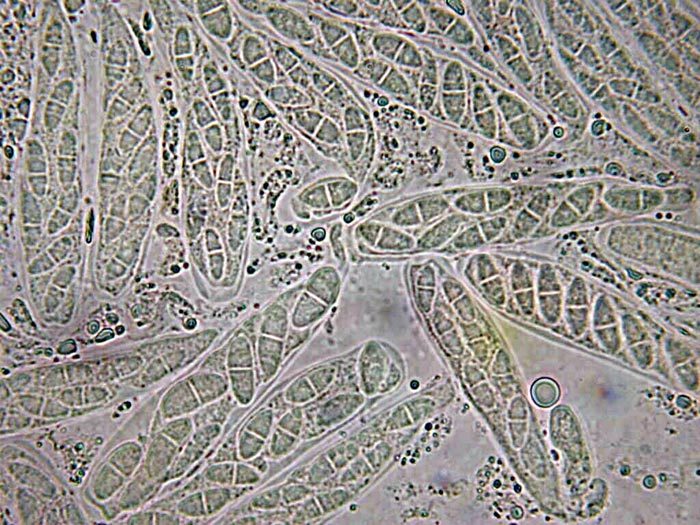 macrostoma