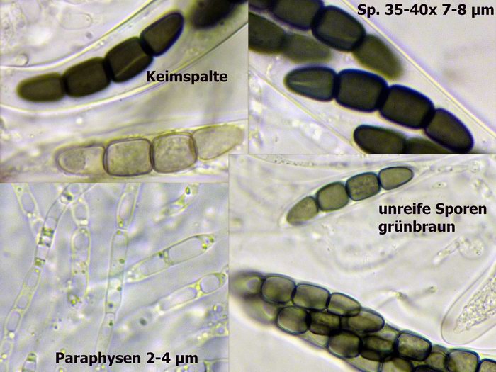 macrostoma