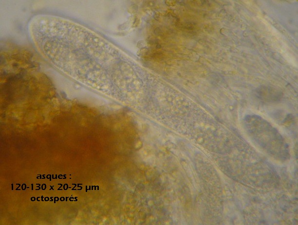 macrostoma