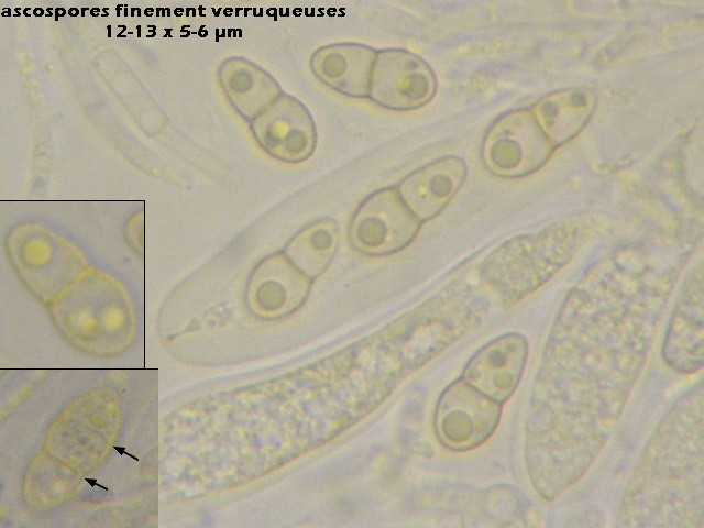 macrostoma