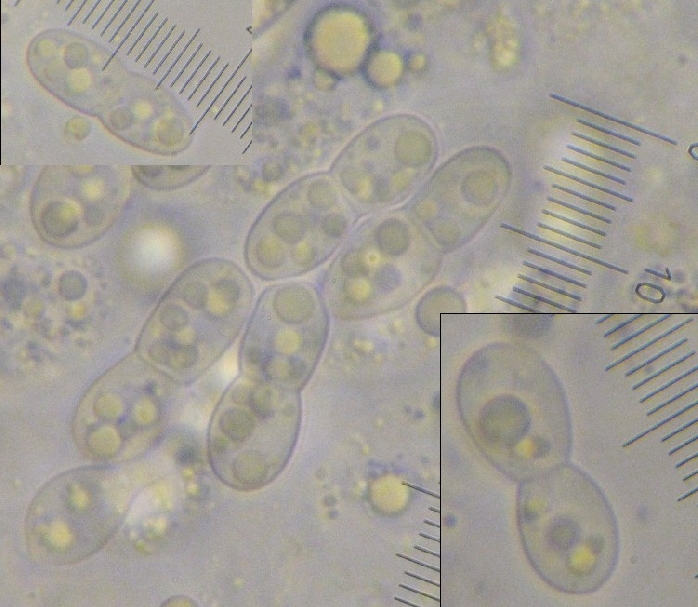 macrostoma