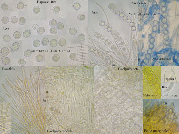 macrostoma
