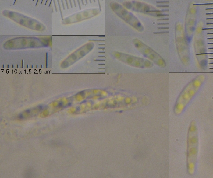 macrostoma