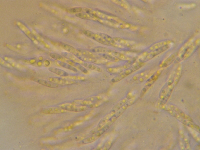 macrostoma