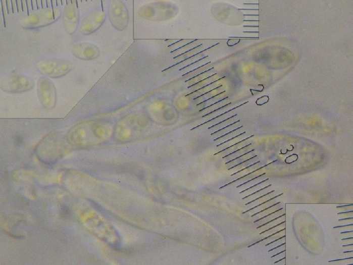 macrostoma