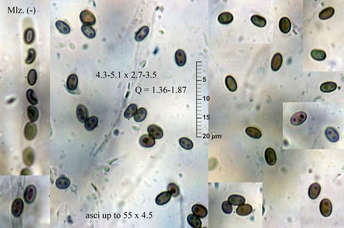 macrostoma