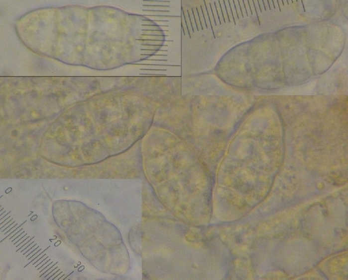 macrostoma