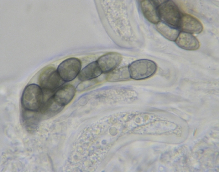 macrostoma