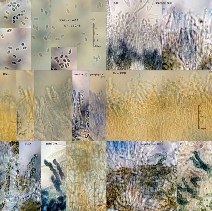 macrostoma