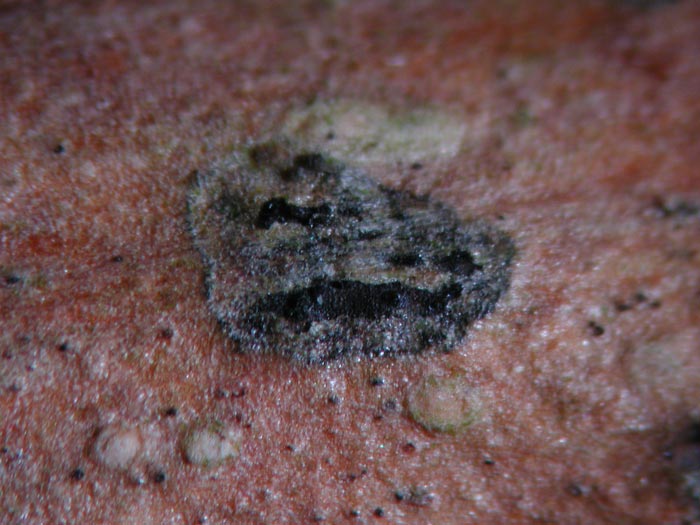 macrostoma