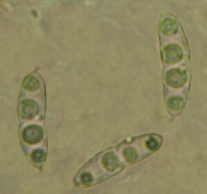macrostoma