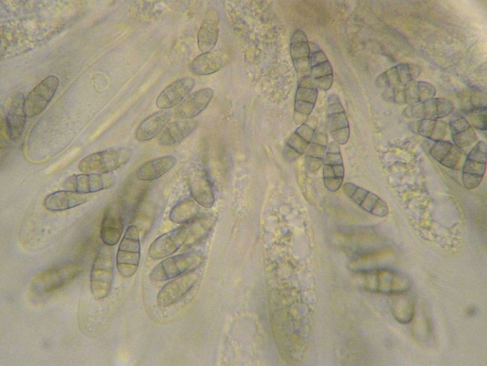 macrostoma