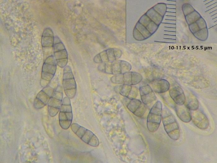 macrostoma