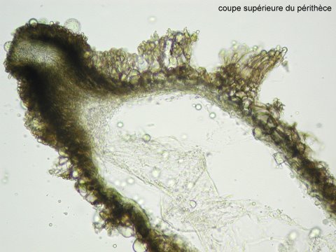 macrostoma